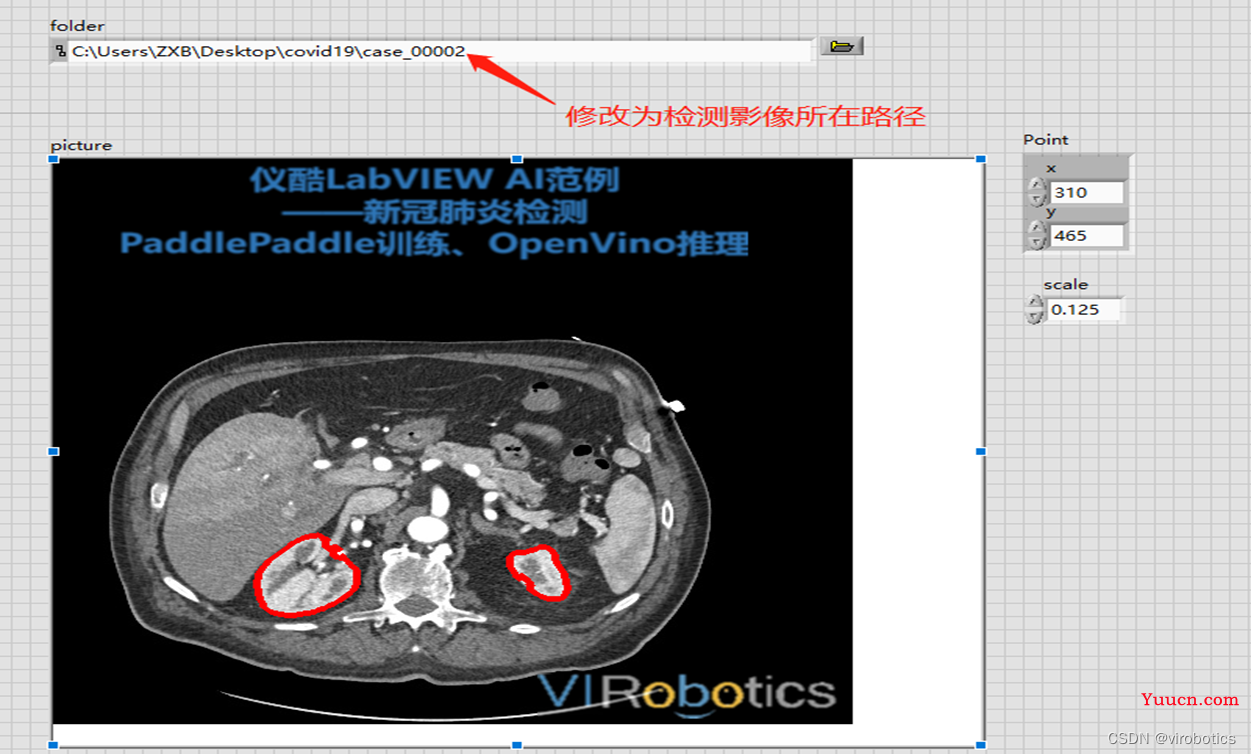 LabVIEW+OpenVINO在CPU上部署新冠肺炎检测模型实战