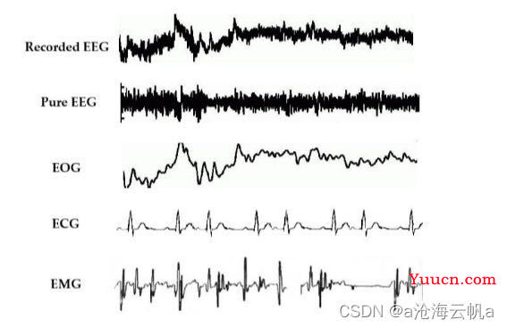 脑电图（EEG）信号去噪方法简述