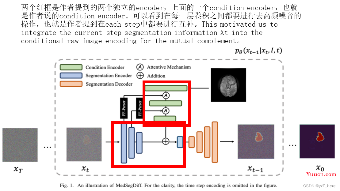 MedSegDiff： Medical Image Segmentation with Diffusion Probabilistic Model