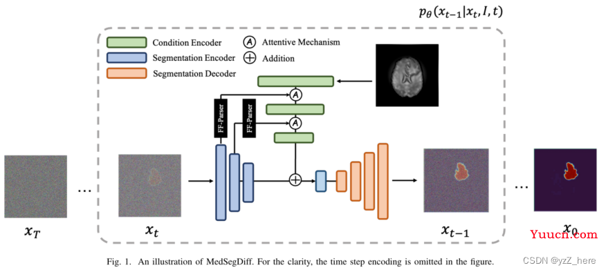 MedSegDiff： Medical Image Segmentation with Diffusion Probabilistic Model