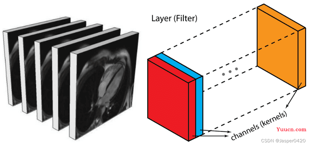 深度学习实战（十）：使用 PyTorch 进行 3D 医学图像分割